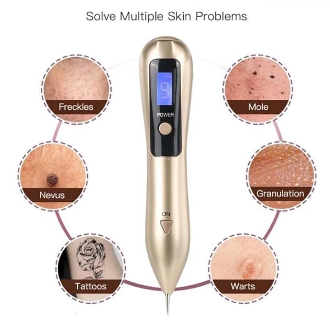 5-in-1 Plasma Jet Pen - Tattoo, Wart & Skin Lesion Removal1 - Image 8